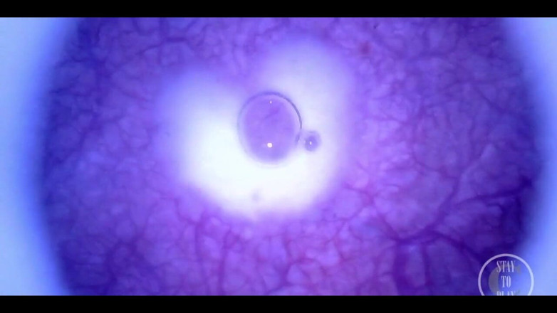 Lina Free: Vacker inuti POV av min fulla urinblåsa med endoskopet!