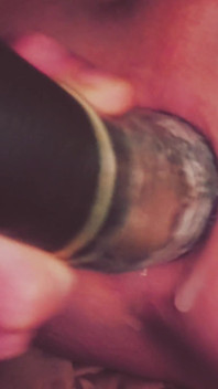 Dilatation Anal