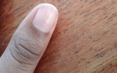 Bexle: Začátek cesty