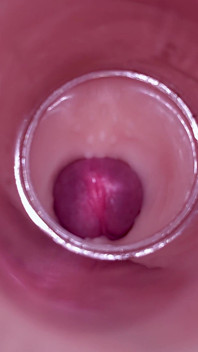 Ženské inseminace - vnitřní kamera zachycuje hlubokou mužskou ejakulaci