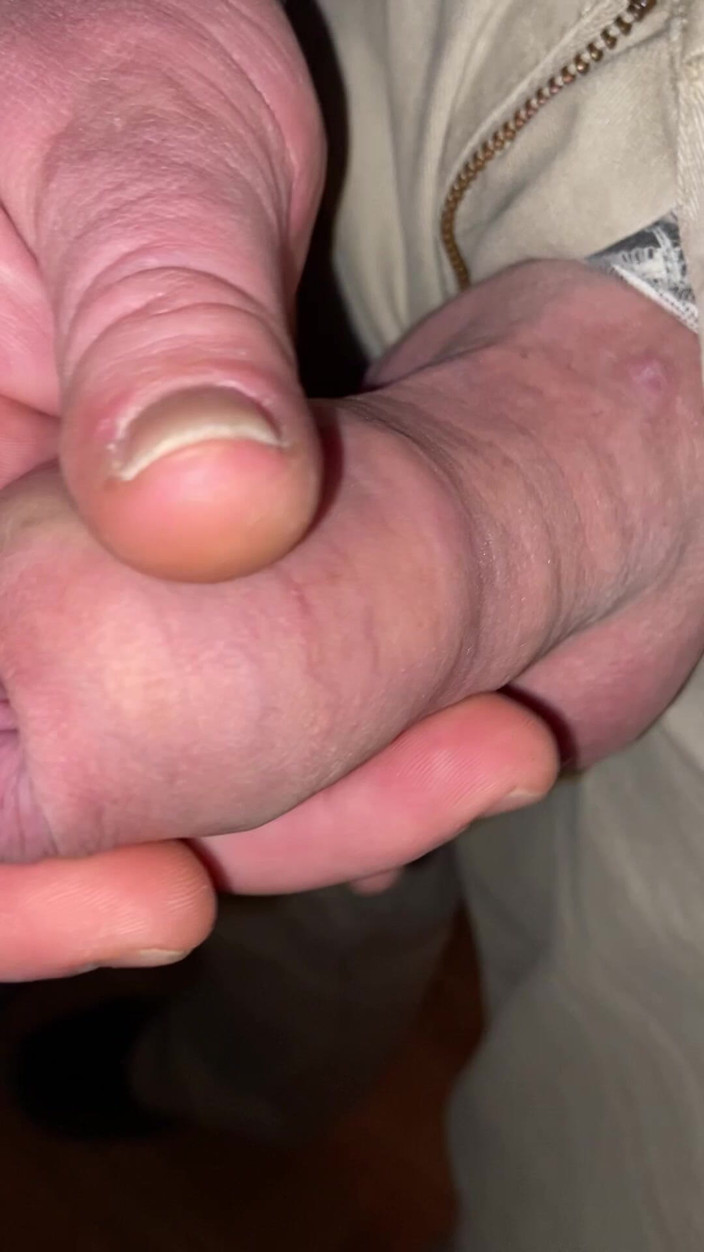 Foreskinguy: 特写头紧包皮