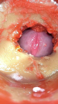 Camera in Anal Cervix POV, Tiny Cucked by Giant ‘couple’, Cum in Anal and Creampie - Asmr