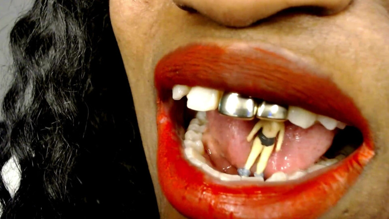 Maeling: Piccolo dentista ha fissato i denti giganti - una battaglia di...