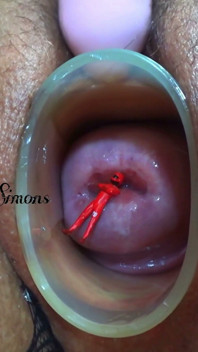 This Is What My Cervix Looks Like After a Year Without Seeing It.