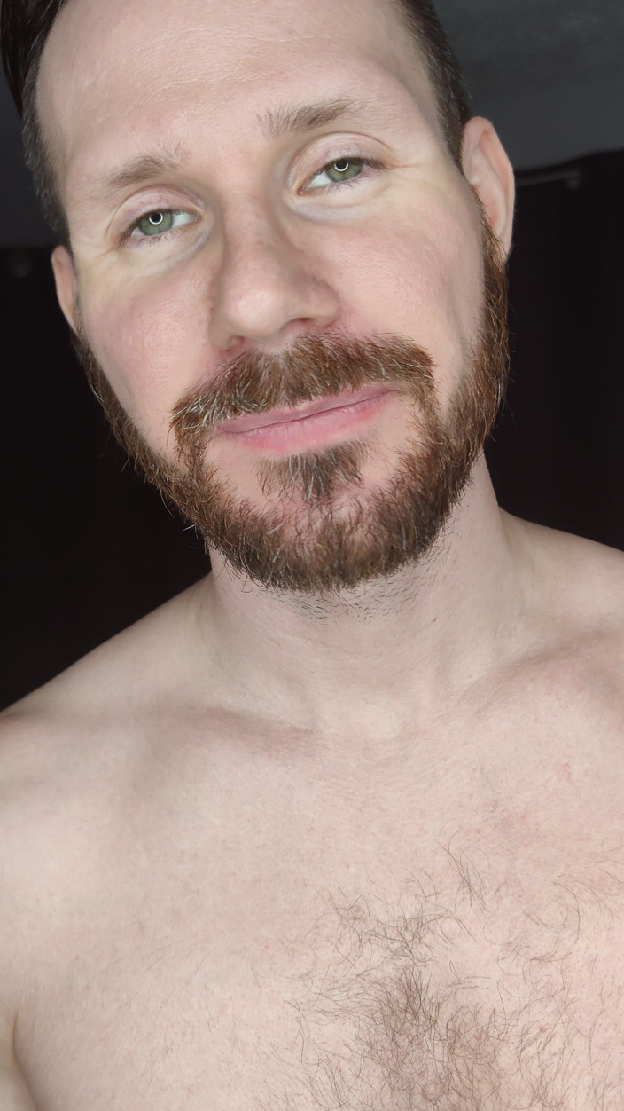 Albino Adonis: Vítej