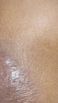 Trying to Get the Sperm Out, It Was so Deep That It Didn't Come Out