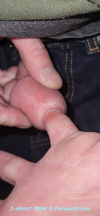 Gaping Urethra - Marker and Pinky Insertion