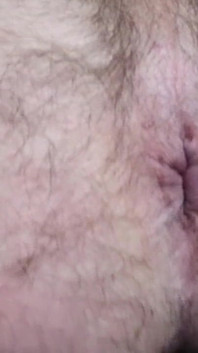 Primer culo