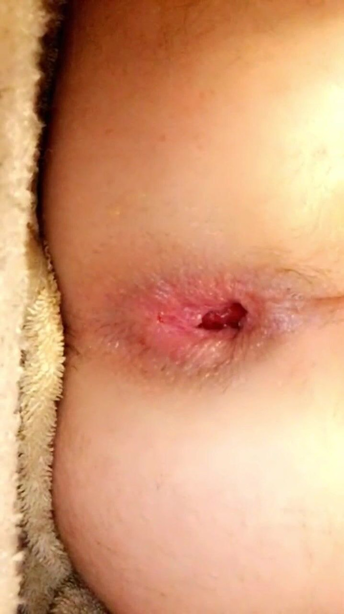 Bottomfemboi: Sumbat punggung saya dengan palam. Sedap