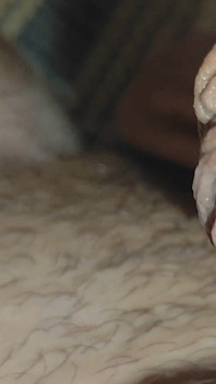 Detaching the Foreskin From the Glans Slowly.