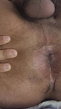 Pancutan mani, lubang, janggut, badan berbulu yang semakin berbulu