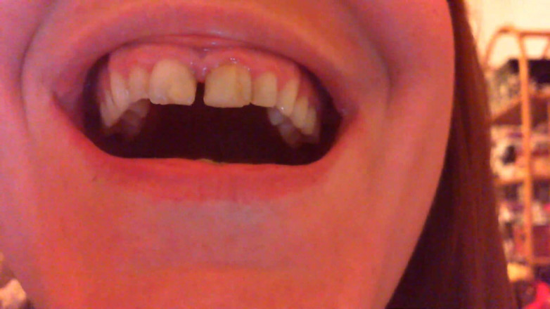 Nicoletta Embassi: Teeth Fetish Devour