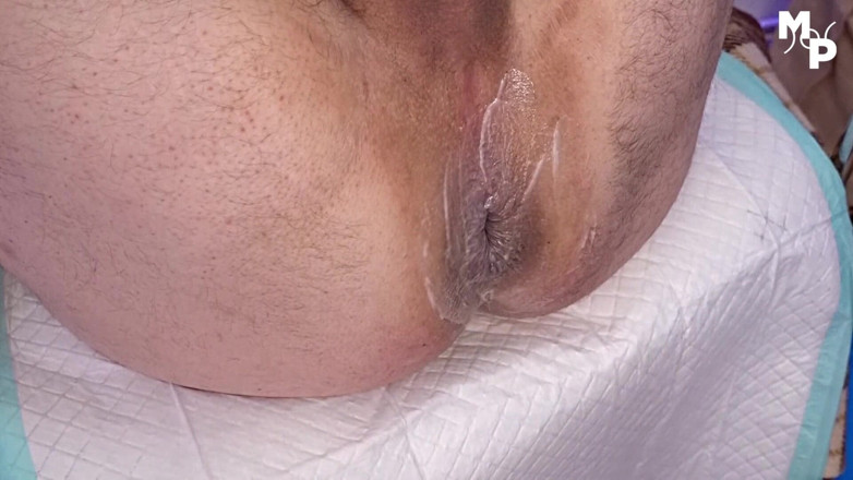 Marcus Pollack Gay: Twinky boy wants to fist my prolapse out