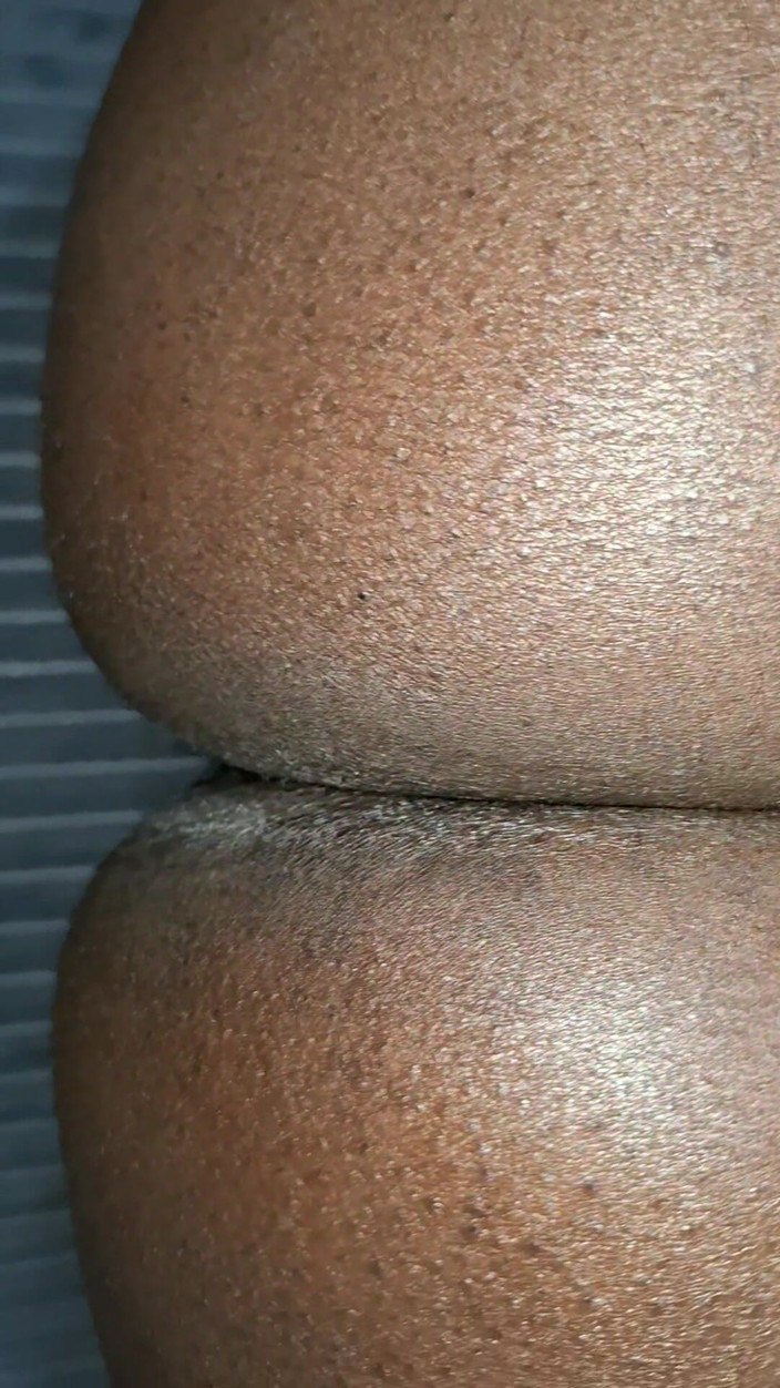 BMCs: Ich hüpfte auf dem größten schwanz Afrikas, bis ich in...