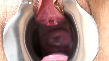 TripleXTransMan: मेरी गर्भाशय ग्रीवा में घुसना!