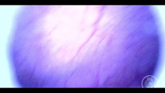 Lina Free: Krásná uvnitř POV mého plného močového měchýře s endoskopem!