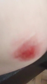Penis