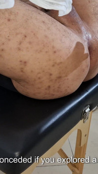 Si Dia pergi ke pakar Urologi kerana dia tidak lagi merasa keseronokan dan dia tersangkut strap-on ke dalamnya sehingga dia datang.