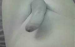 Ablation d’un cathéter