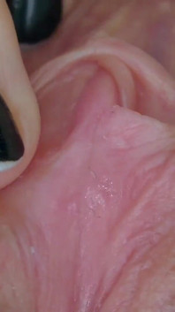 Clitóris e Vagina
