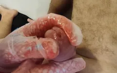 Acorn Massage