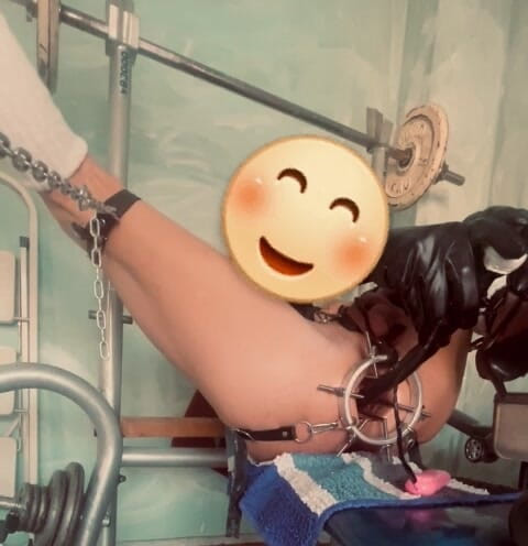 Analguy: Yeni Esnetme