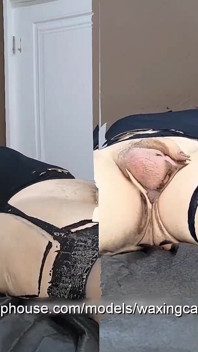 Depilação a um homem em meias por duas enfermeiras com luvas