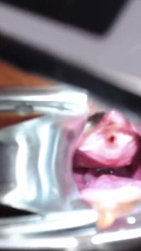 Speculum Cervix & Anal Exam Great View Inside