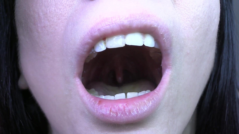 Quinn brooks: My Uvula