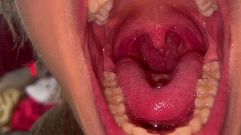 Glitterqueen1999: Tour Mulut Tanpa Solek Kiraan Gigi Uvula Check Tonsil