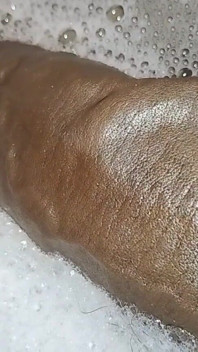 Thick Veins on Cms BBC