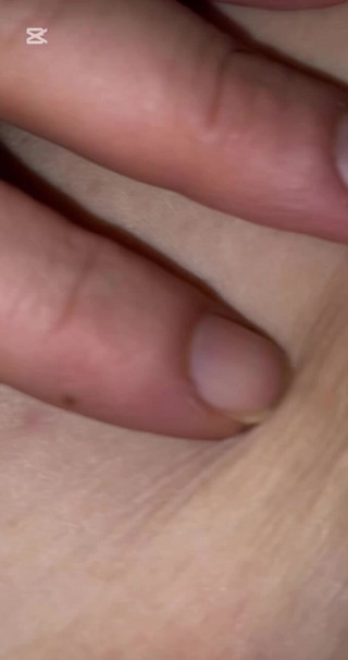 Mudur_bey35: 불같은 비명