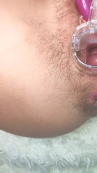 야외에서 speculum_orgasm 클로즈업