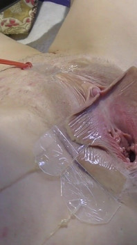 3 Lamiéndose La Vagina Se Extiende Muy Cerca
