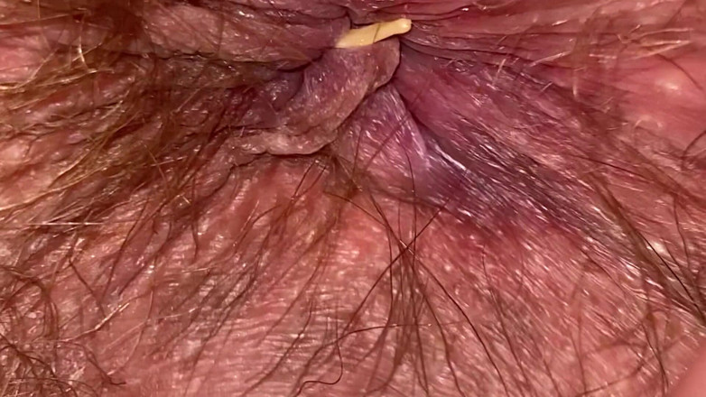Cuteblonde666: Obří fetiš video chlupatý zadek extrémní detailní