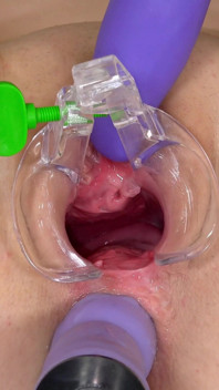 Beautiful Teen Gets Anal Orgasm with a Speculum Inside Her Pussy