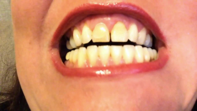 Lily Lipstixxx: Inspecție la gură - Ai grijă, mușc!