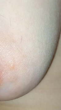 Hairy Breasts
