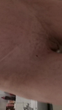 Nez Von