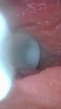 Diamo una sbirciatina nella mia figa succosa insieme (endoscope camera)