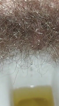 Tôi đi tiểu rất nhiều lần nữa