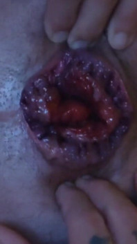 My Hole