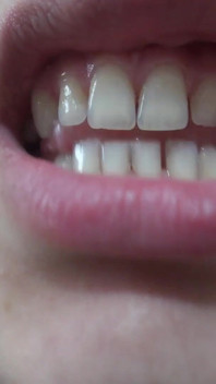 Ma demi-sœur indienne me montre à l’intérieur de sa bouche sa langue et ses dents