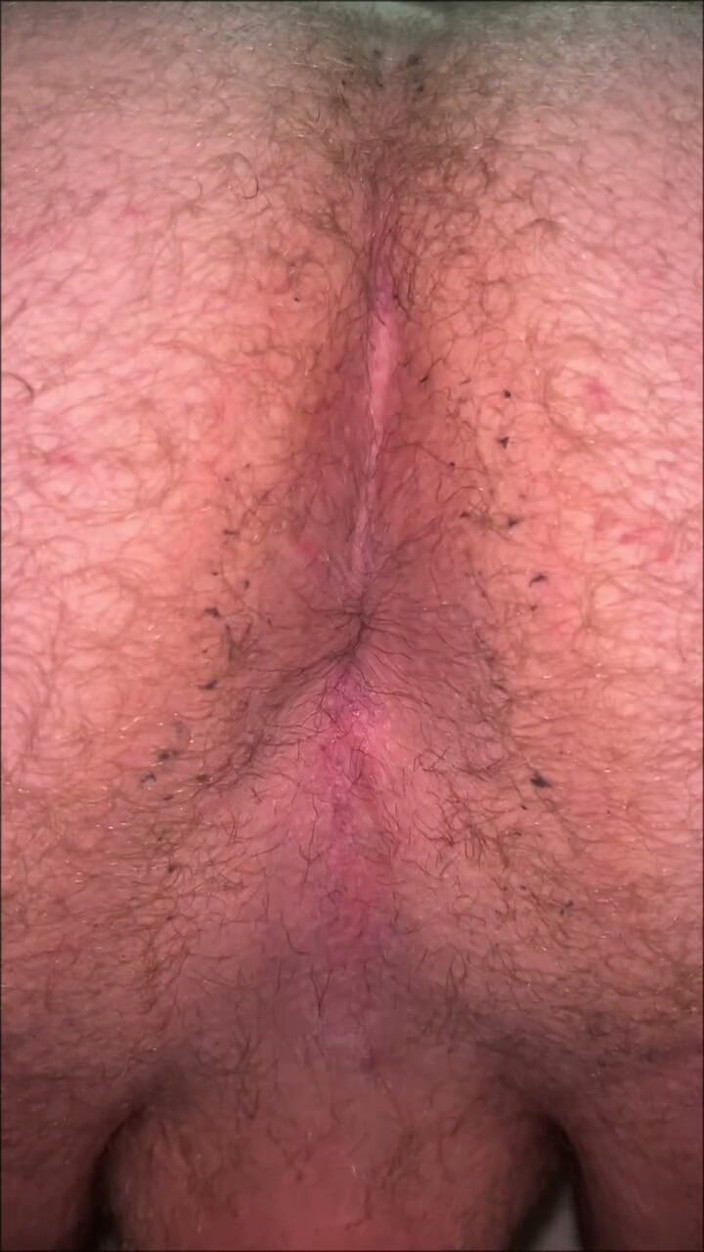 Makssssimus: Dirty Fatass Ass and a Tiny Dick