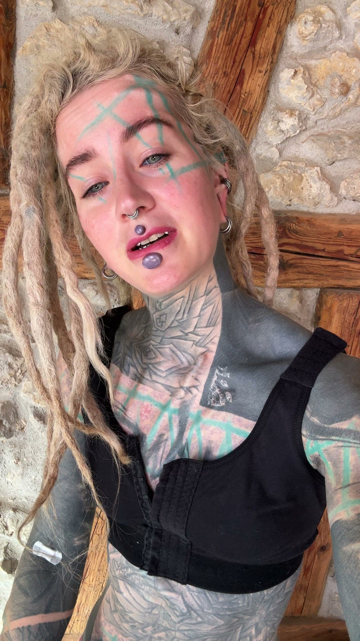 Anuskatzz: I Got New Boobs and an Upper Blephoplasty. I Will...