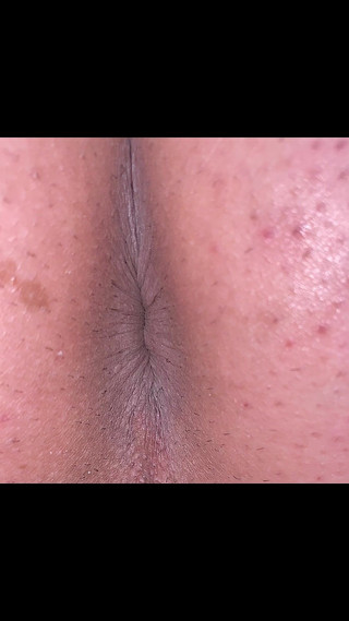 Kyotosigakk: Muž odhaluje svůj zadek Udělejte obrázek, aby byly jasně viditelné...