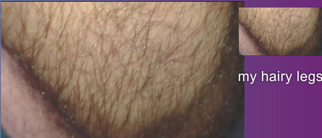Stink HairyMale: 옷의 질감