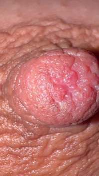 Tepelmontage
