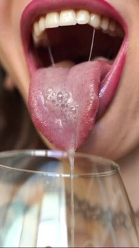 Drool Collector