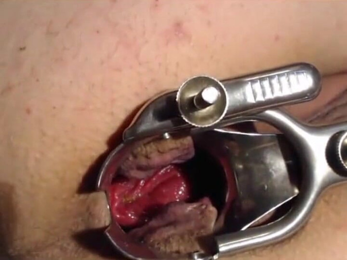Putarankahotmilf: Spéculum anal, prolapsus, mets de l'eau dans mon cul et...